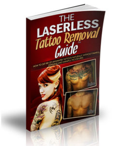 tattoo removal